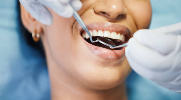 Best Emergency Dental Extractions in Leland Grove, IL